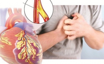Người cao tuổi cần biết: Các loại bệnh mạch vành thường gặp