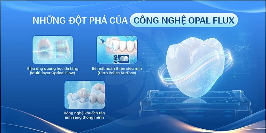 Răng sứ Opal Flux chú trọng tái tạo chiều sâu quang học và vẻ đẹp tự nhiên vốn là tiêu chuẩn cao nhất của nha khoa hiện đại