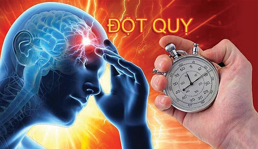 Nguy cơ đột qụy xuất huyết não ở người bệnh cao tuổi mắc nhiều bệnh nền