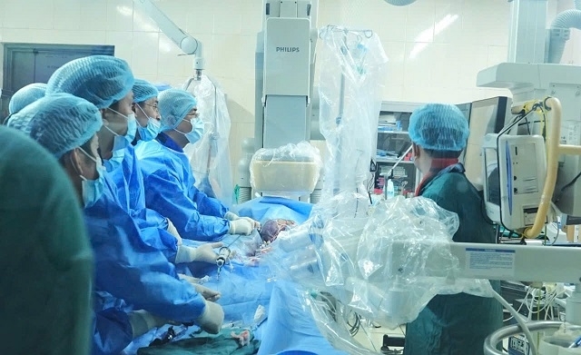 Ca bệnh thay van động mạch chủ qua đường ống thông phức tạp của các bác sĩ tim mạch bệnh viện Bạch Mai. Ảnh: minh hoạ
